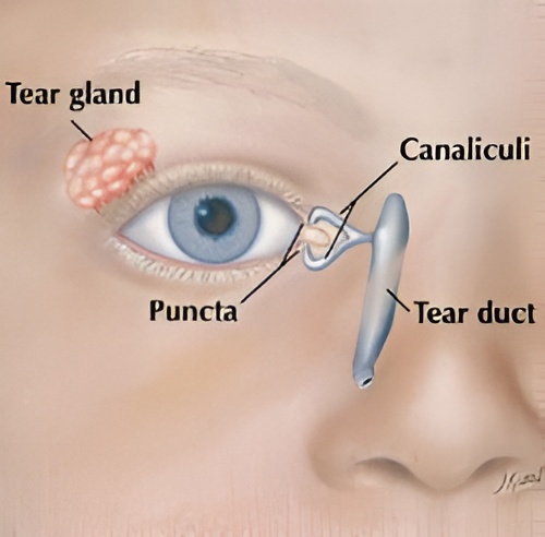 Understanding Blocked Tear Ducts in Children